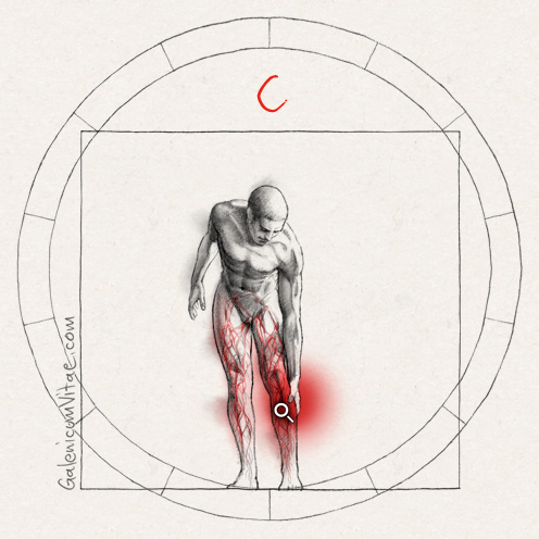 Peripheral artery disease (PAD) y sus causas