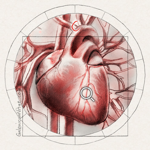 Heart diseases y sus causas