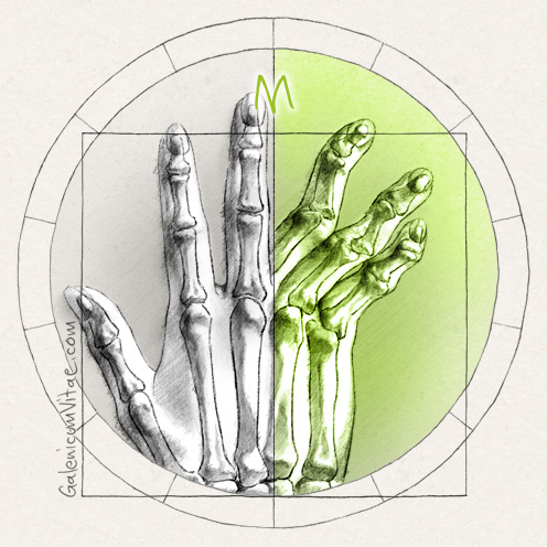 Types of arthritis  y sus causas