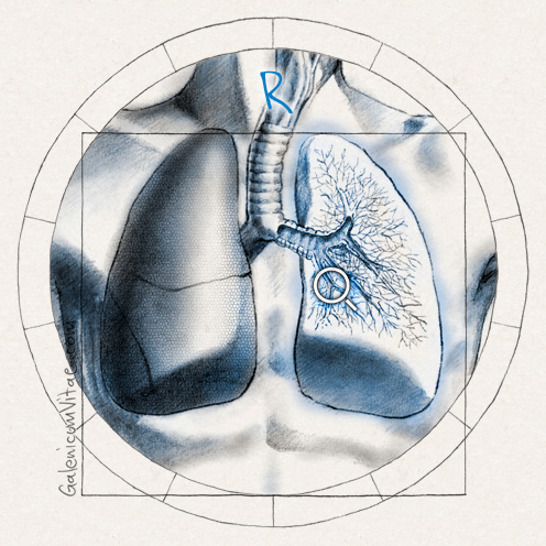 Respiratory symptoms y sus causas
